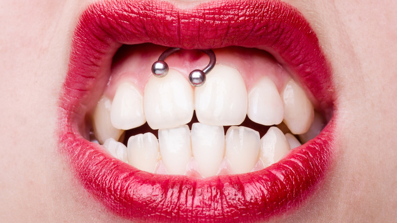 Image of smiley piercing