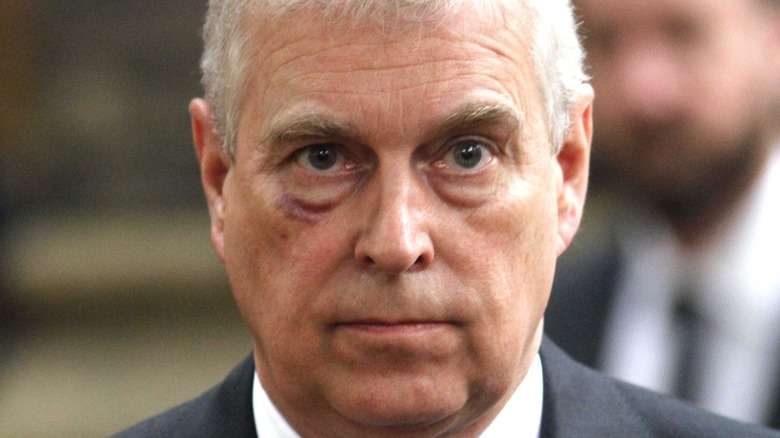 Prince Andrew's face