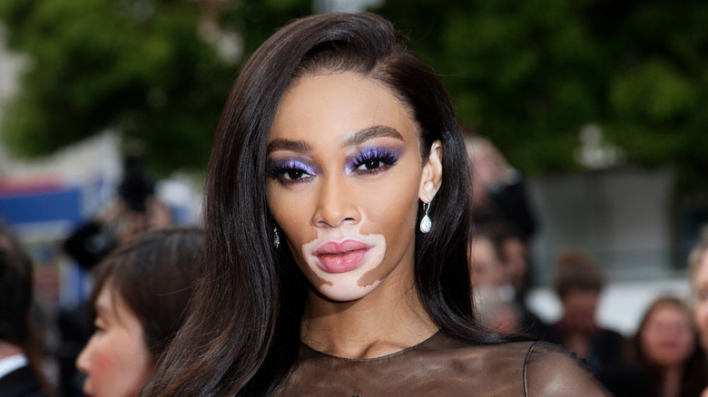 Winnie Harlow posing