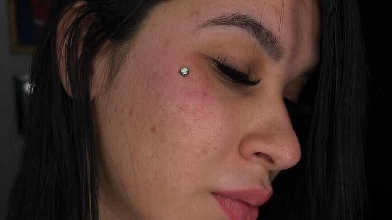 Person with dermal piercing on face