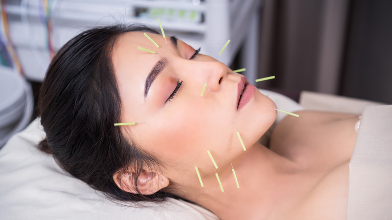 Acupuncture facial