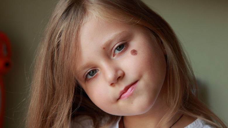 Girl with birthmark