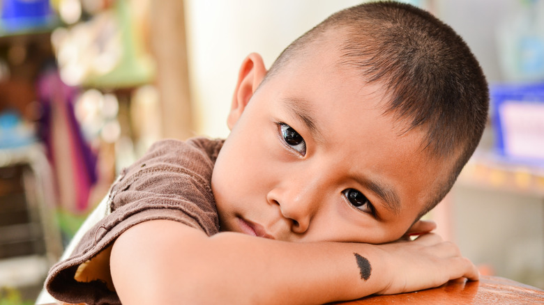 Child with birthmark