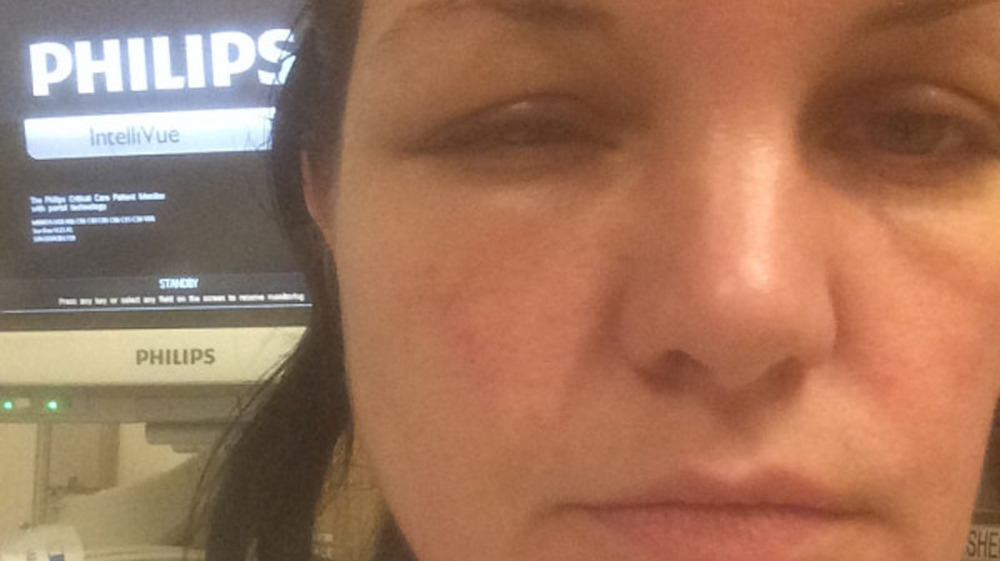 Pauley Perrette with swollen face