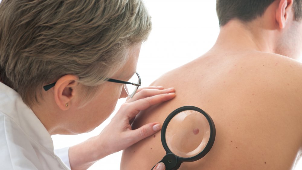 Doctor examining birthmark