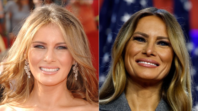 Melania Trump before rumored facelift (L) Melania Trump after rumored facelift (R)