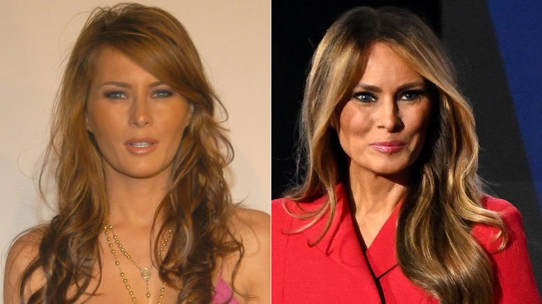 Melania Trump before alleged plastic surgery in pink dress (L) and after alleged plastic surgery in red suit (R)