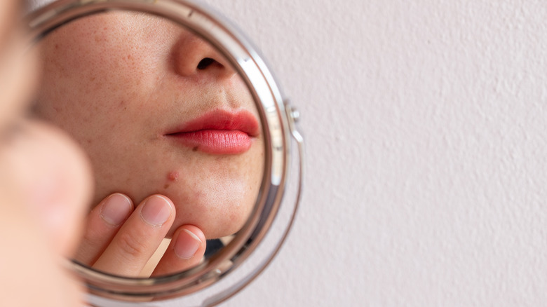 Woman examining acne in mirror