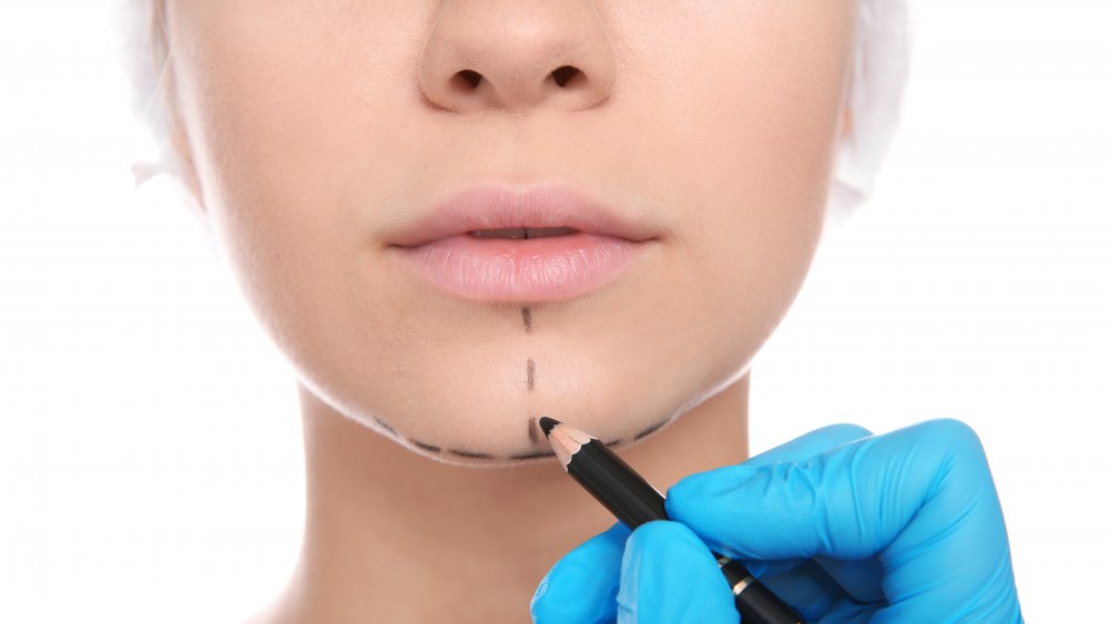 Plastic surgeon working on a woman's chin