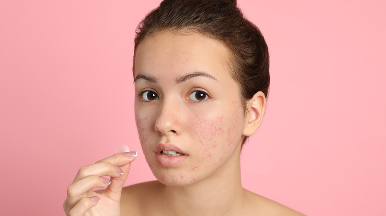 Woman removing hydrocolloid patch from skin