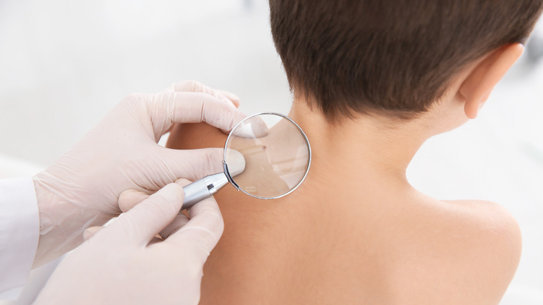 Doctor examining boy's birthmark