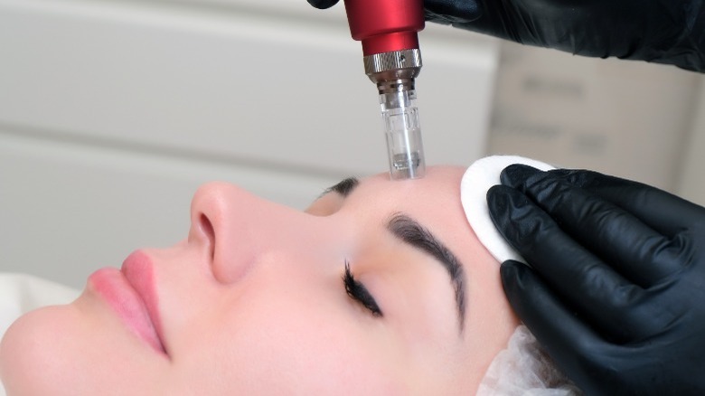 woman receiving microneedle treatment on forehead