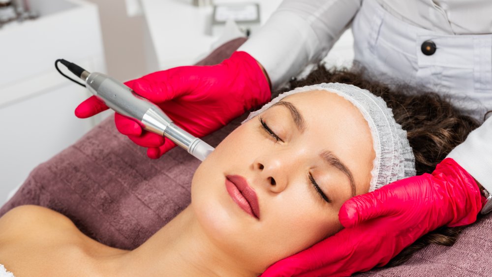 microneedling