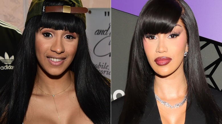 Cardi B before and after plastic surgery 