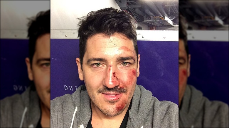 Jonathan Knight with an injury