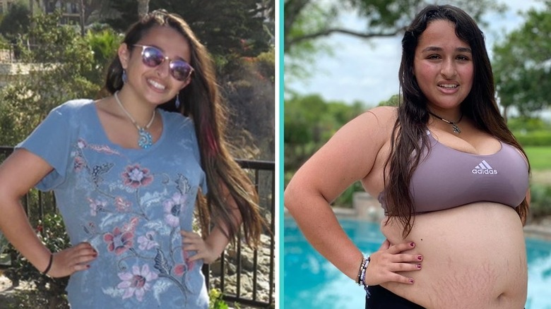 Side by side images of Jazz Jennings posing before and after weight gain comparison