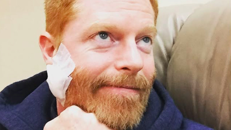 Jesse Tyler Ferguson with a bandage on his face