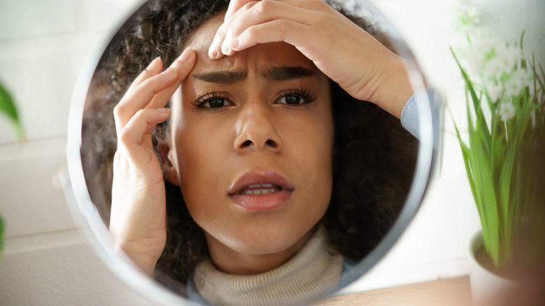 woman touching acne on face