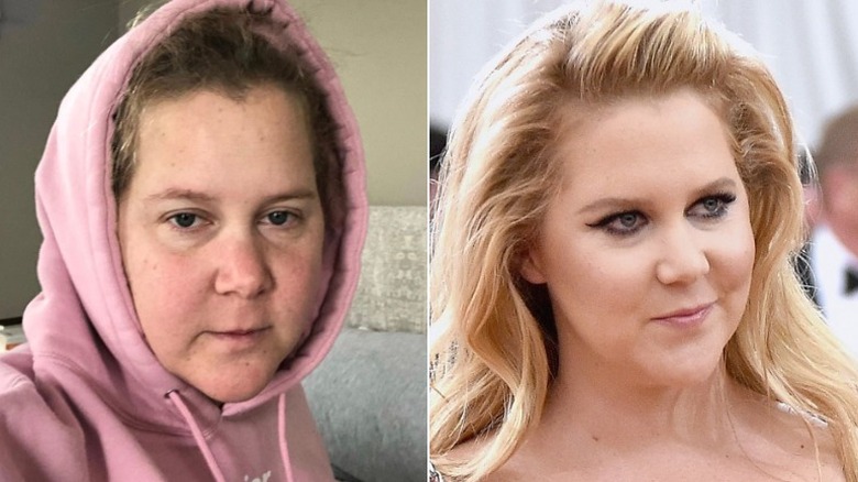 Amy Schumer split image no makeup