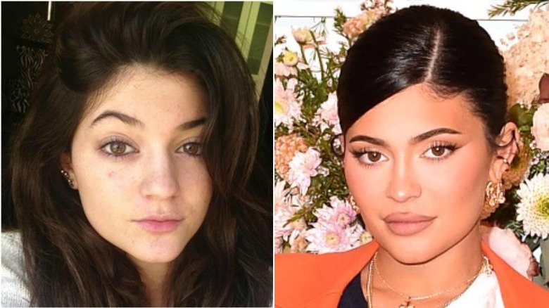 Kylie Jenner split image no makeup