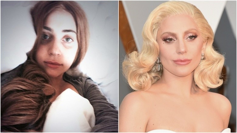 Lady Gaga split image no makeup