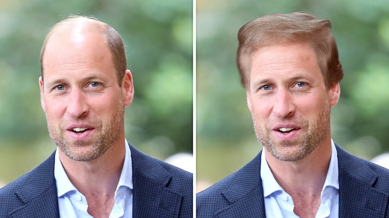 Side-by-side pictures of Prince William with and without Donald Trump's hairstyle