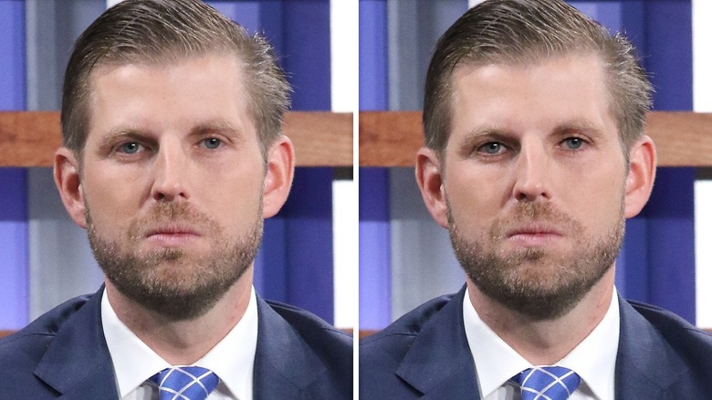 Eric Trump's before and after