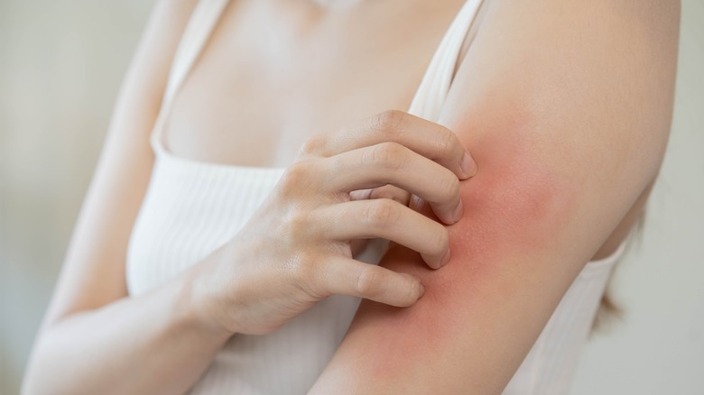 A woman scratching her arm