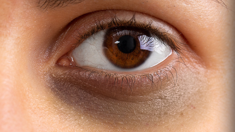 extreme close-up of woman with dark circle