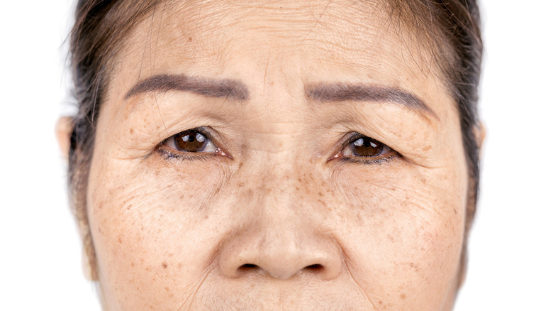 Older woman with freckles