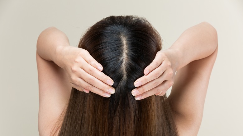 Woman showing her scalp