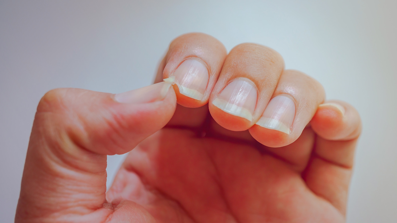 What Causes Your Nails To Split And How Can You Prevent It 