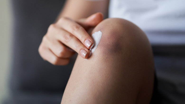 A bruised knee