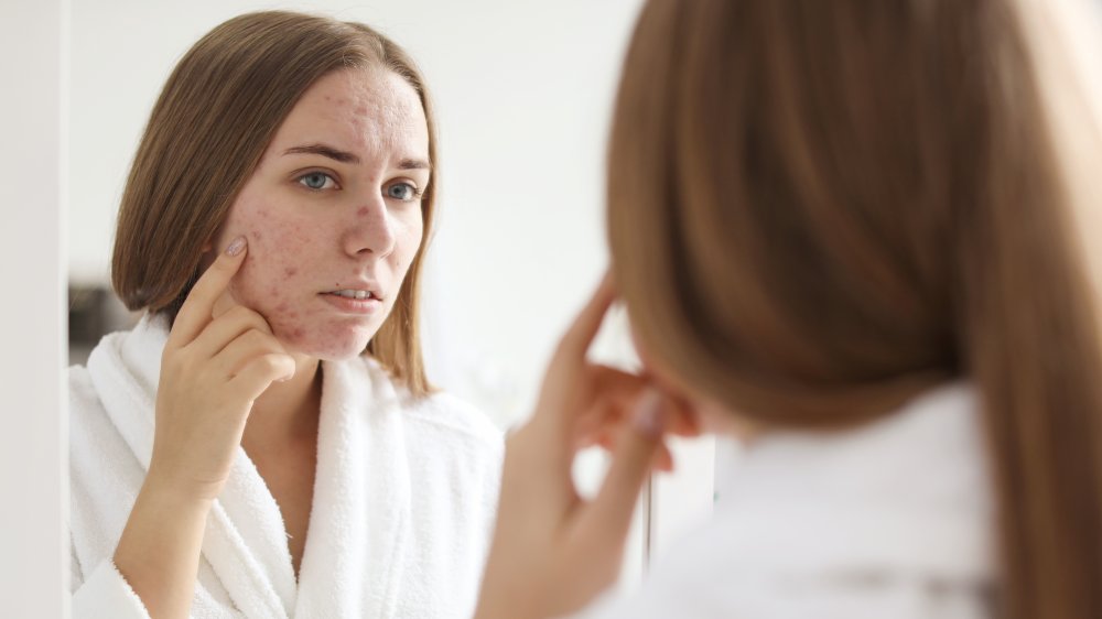 woman examining acne 