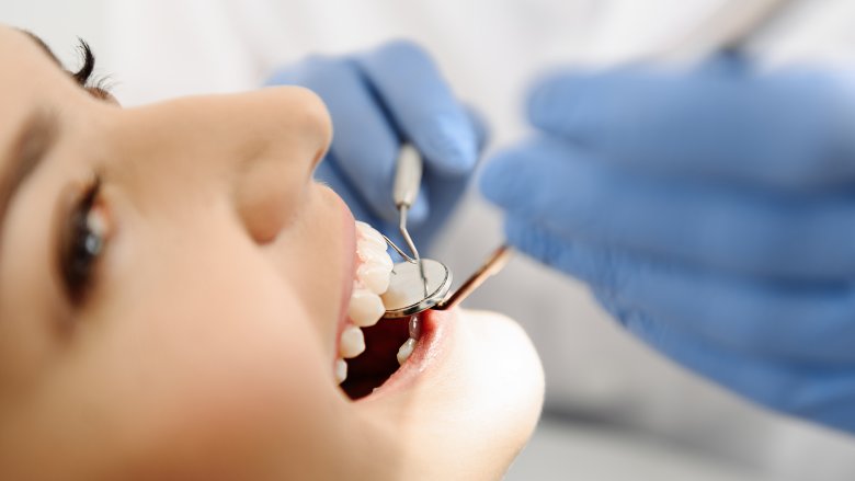 woman at dentist with cavities