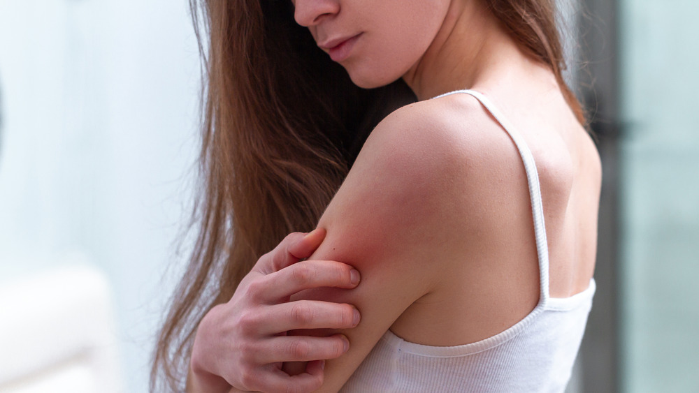 A woman touching her sore arm