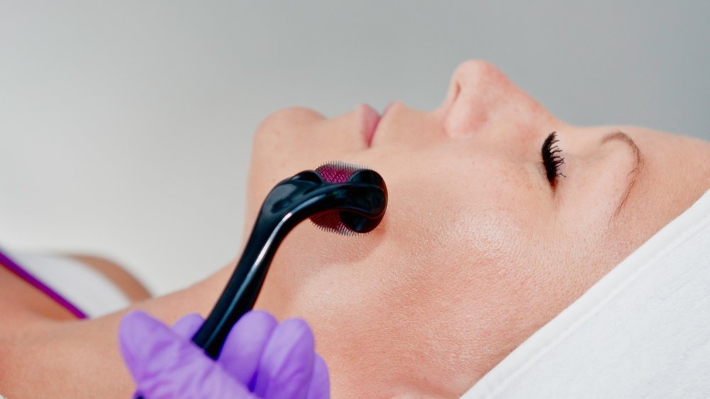 Woman undergoing dermarolling procedure