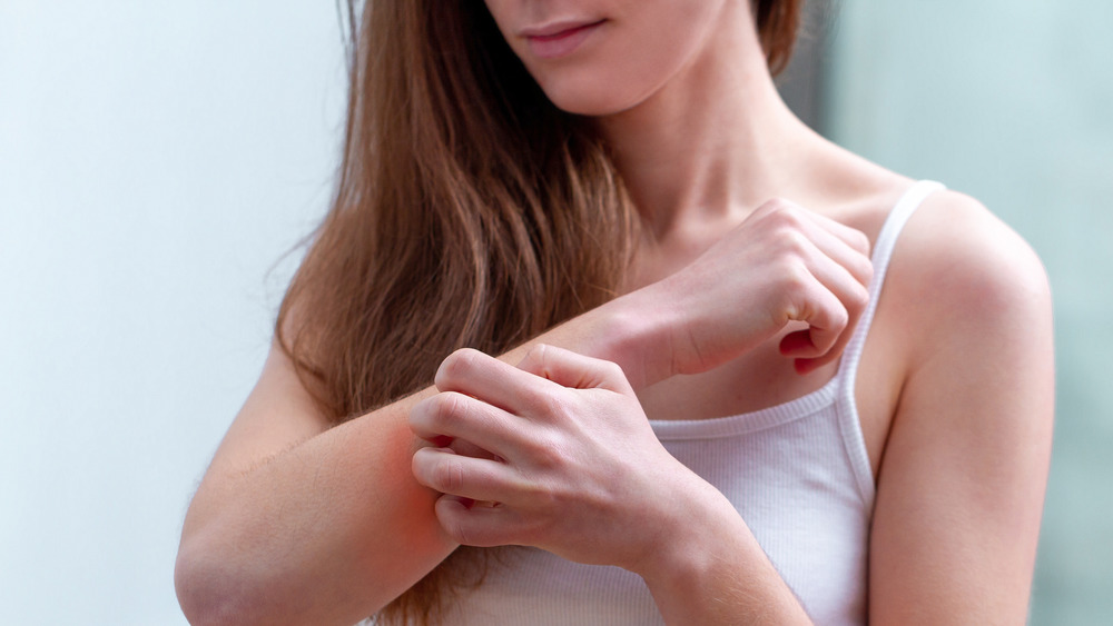 A woman scratching her arm