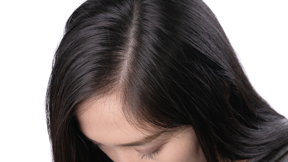 A woman's scalp