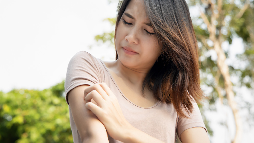 Woman scratching her right arm 