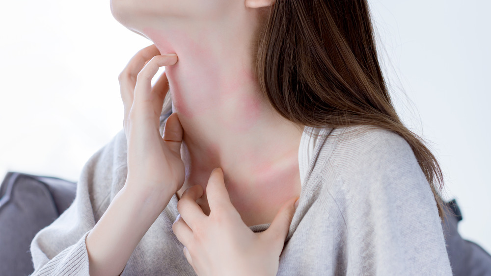 Woman scratching her neck 