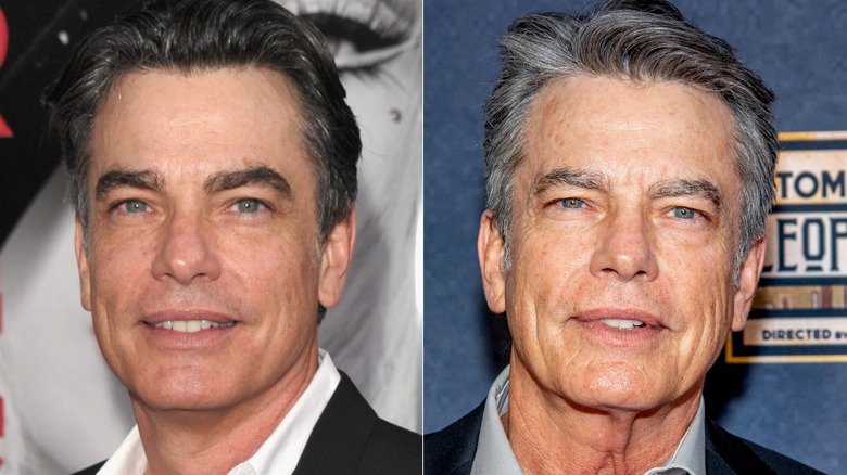 Peter Gallagher then and now