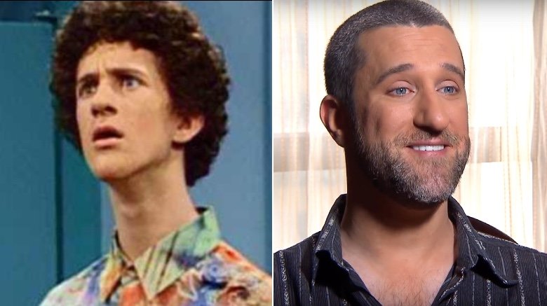 Dustin Diamond (Saved by the Bell's Samuel 'Screech' Powers) then and now