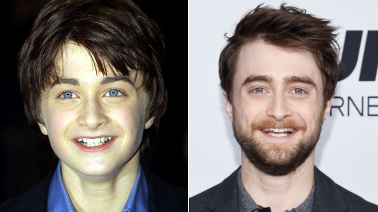 child star Daniel Radcliffe then and now