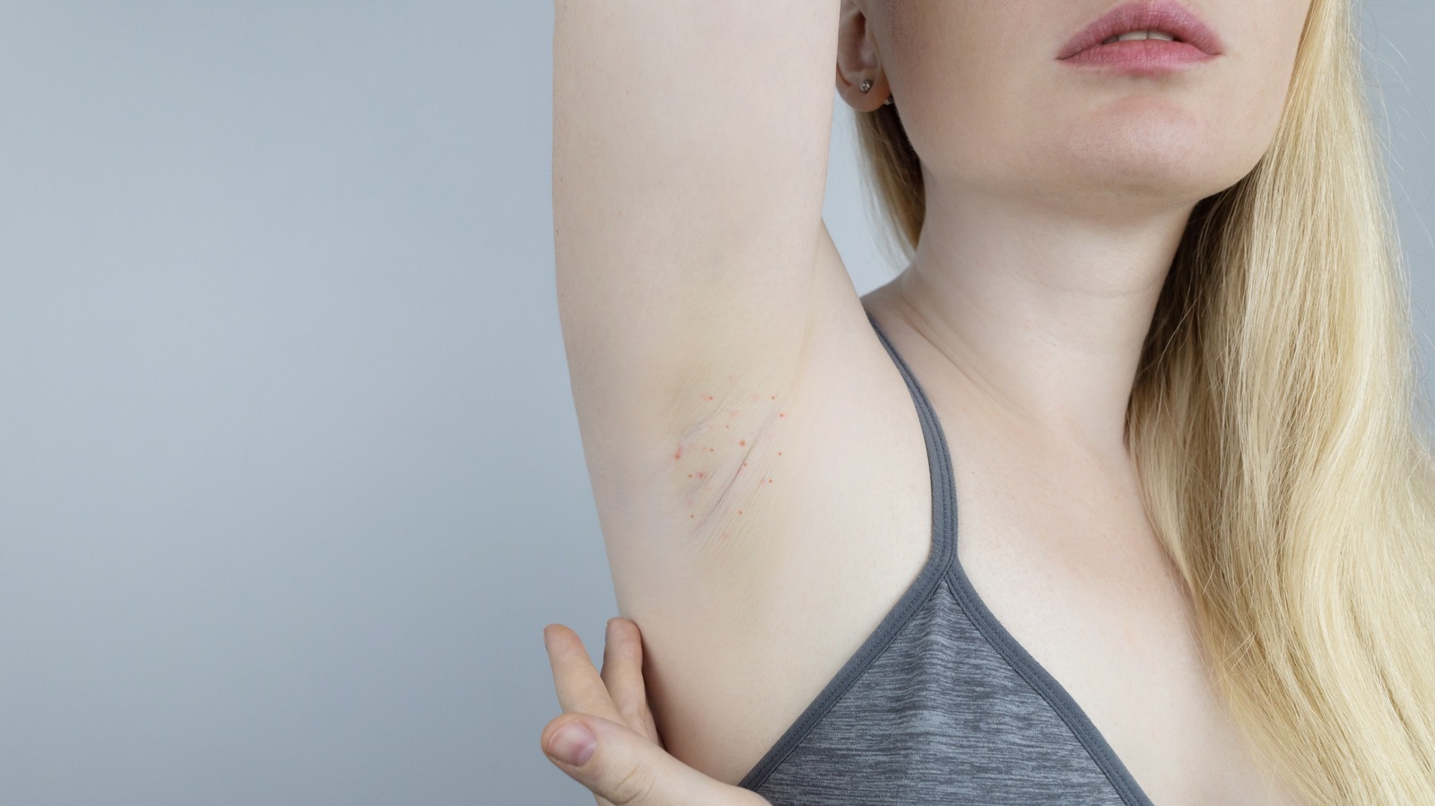 What To Do If Your Deodorant Is Giving You A Rash