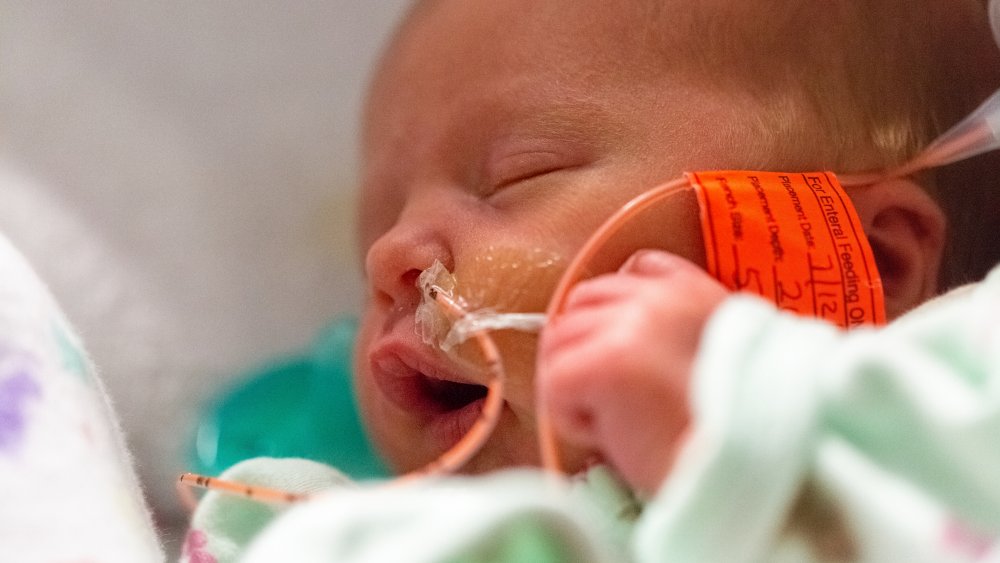 feeding tube in NICU