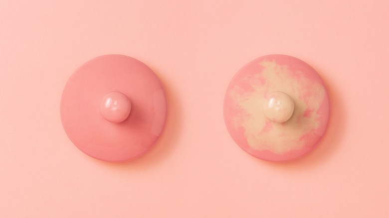 Two teapot lids symbolizing a normal and inflamed breast