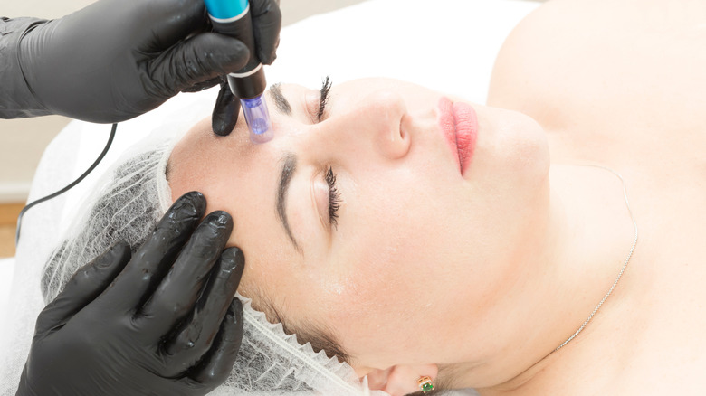 Microneedling