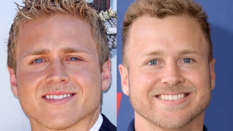 Spencer Pratt smiling, then and Now