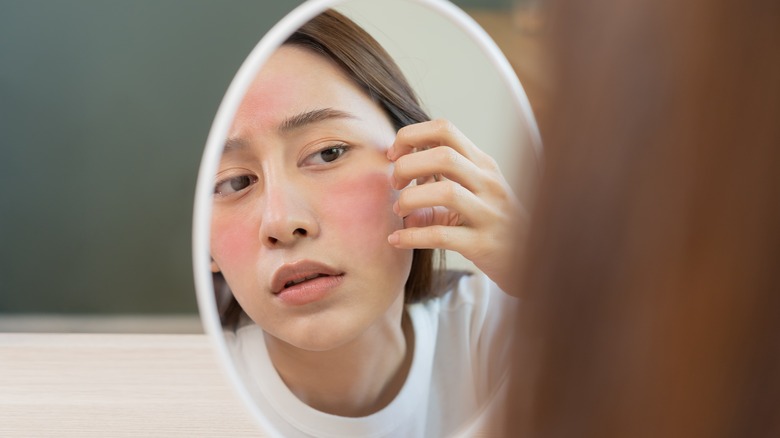 woman with rosacea scratching face in mirror